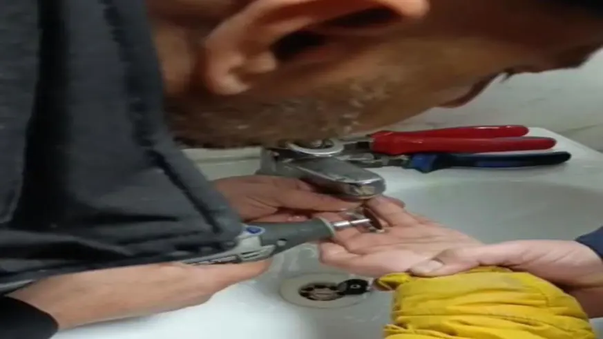 Parmağını metal paraya sıkıştırdı