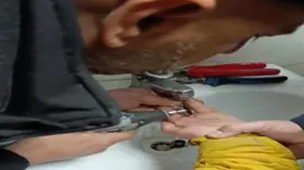 Parmağını metal paraya sıkıştırdı