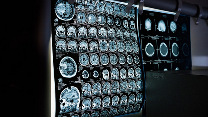 Tüm zamanların en yüksek günlük kanser tarama sayılarına ulaştık