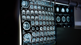 Tüm zamanların en yüksek günlük kanser tarama sayılarına ulaştık