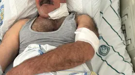 At sahibini ısırdı