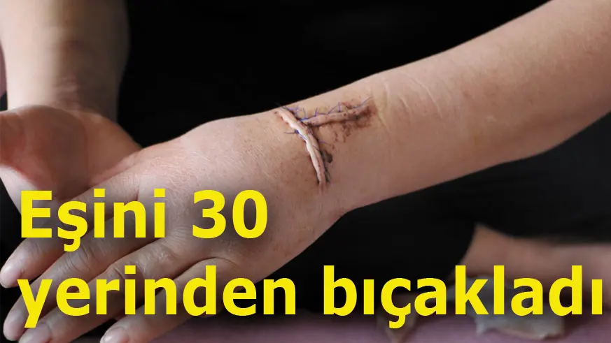 Eşini 30 yerinden bıçakladı