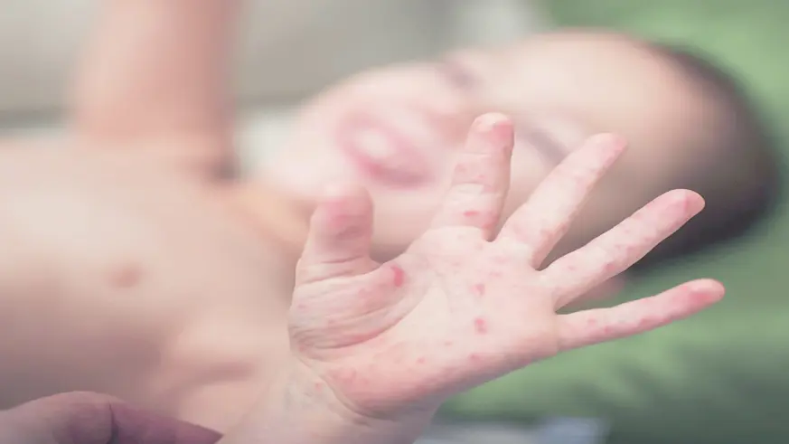 En riskli grup 5 yaş altındaki çocuklar!