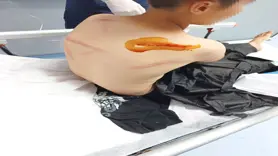 11 yaşındaki çocuğa öldüresiye dayak